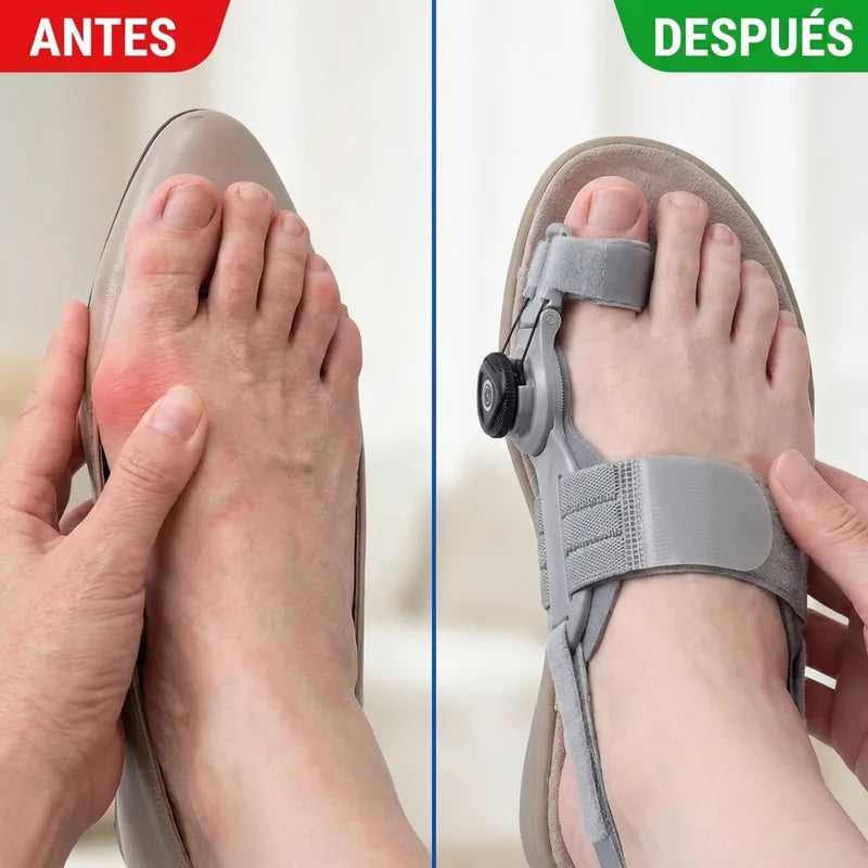 Antes y después