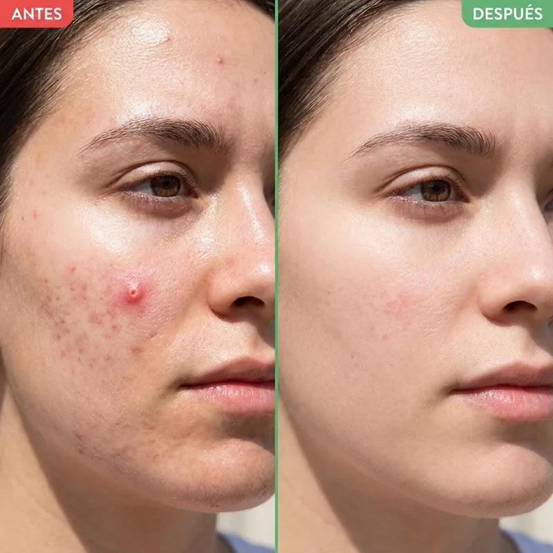 Antes y después